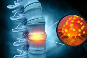 Костные опухоли kemik-tumorleri-2792494.jpg